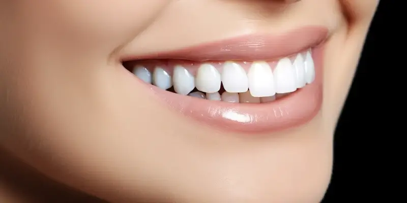 Różnice między licówkami porcelanowymi a kompozytowymi