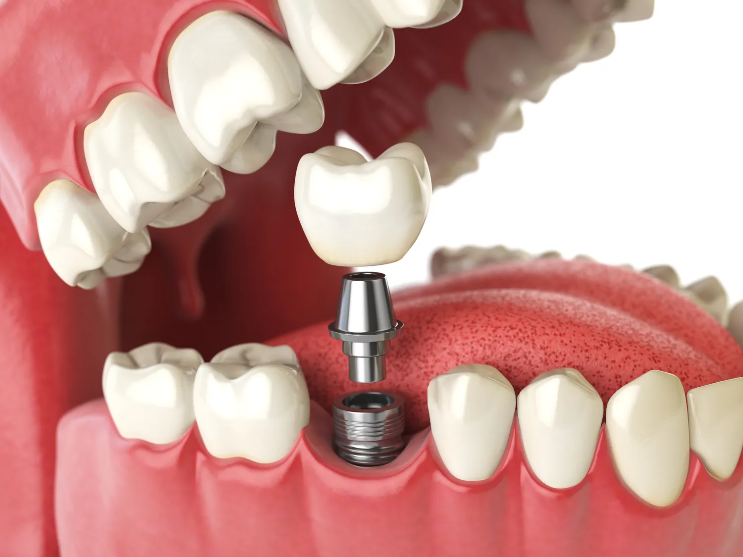 Dlaczego regularne wizyty u dentysty są tak ważne?