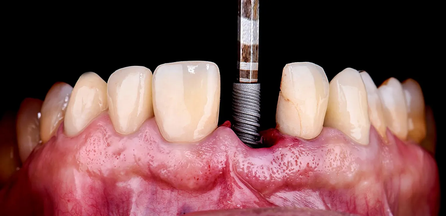 Dzieci u dentysty