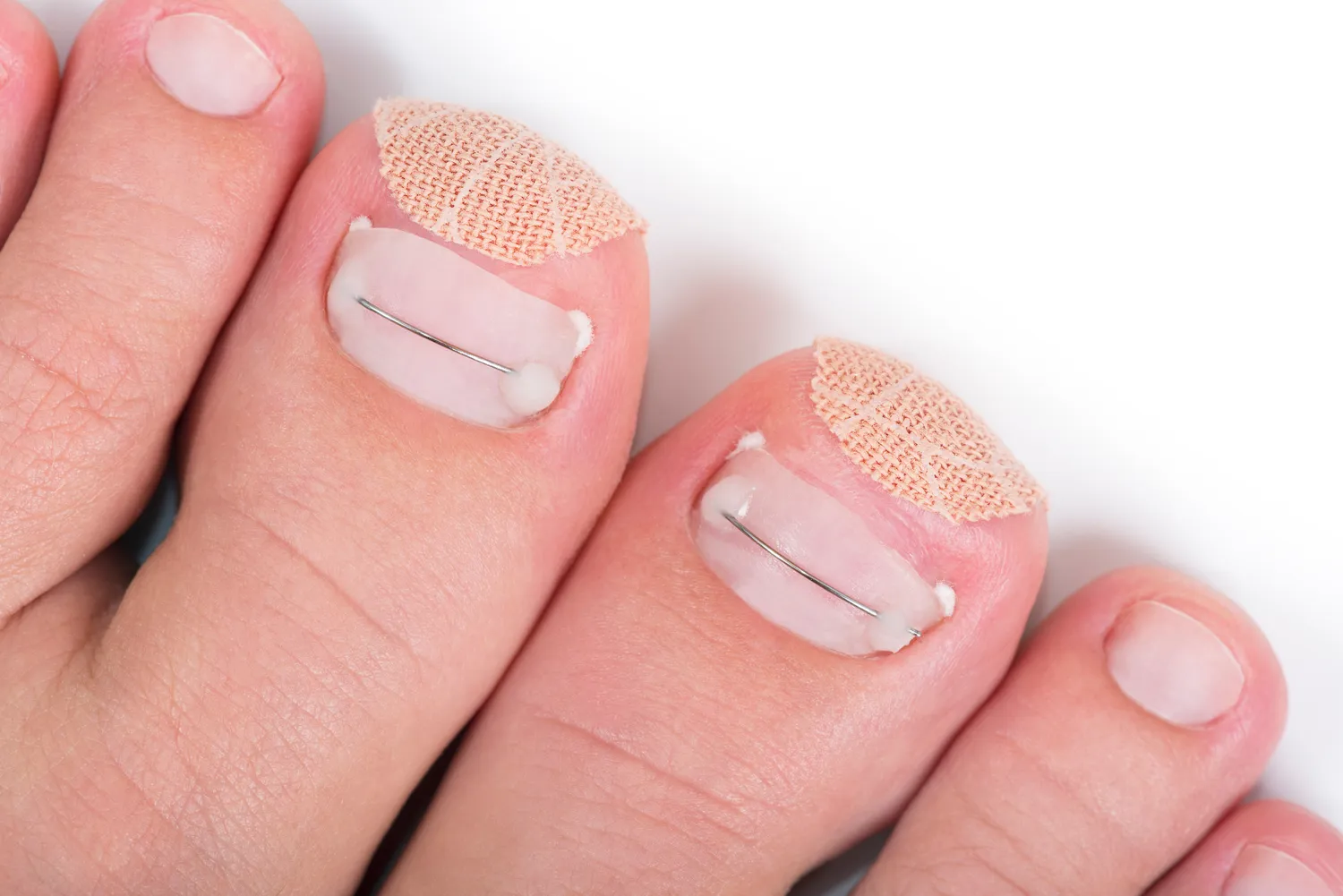 Pedicure podologiczne Szczecin