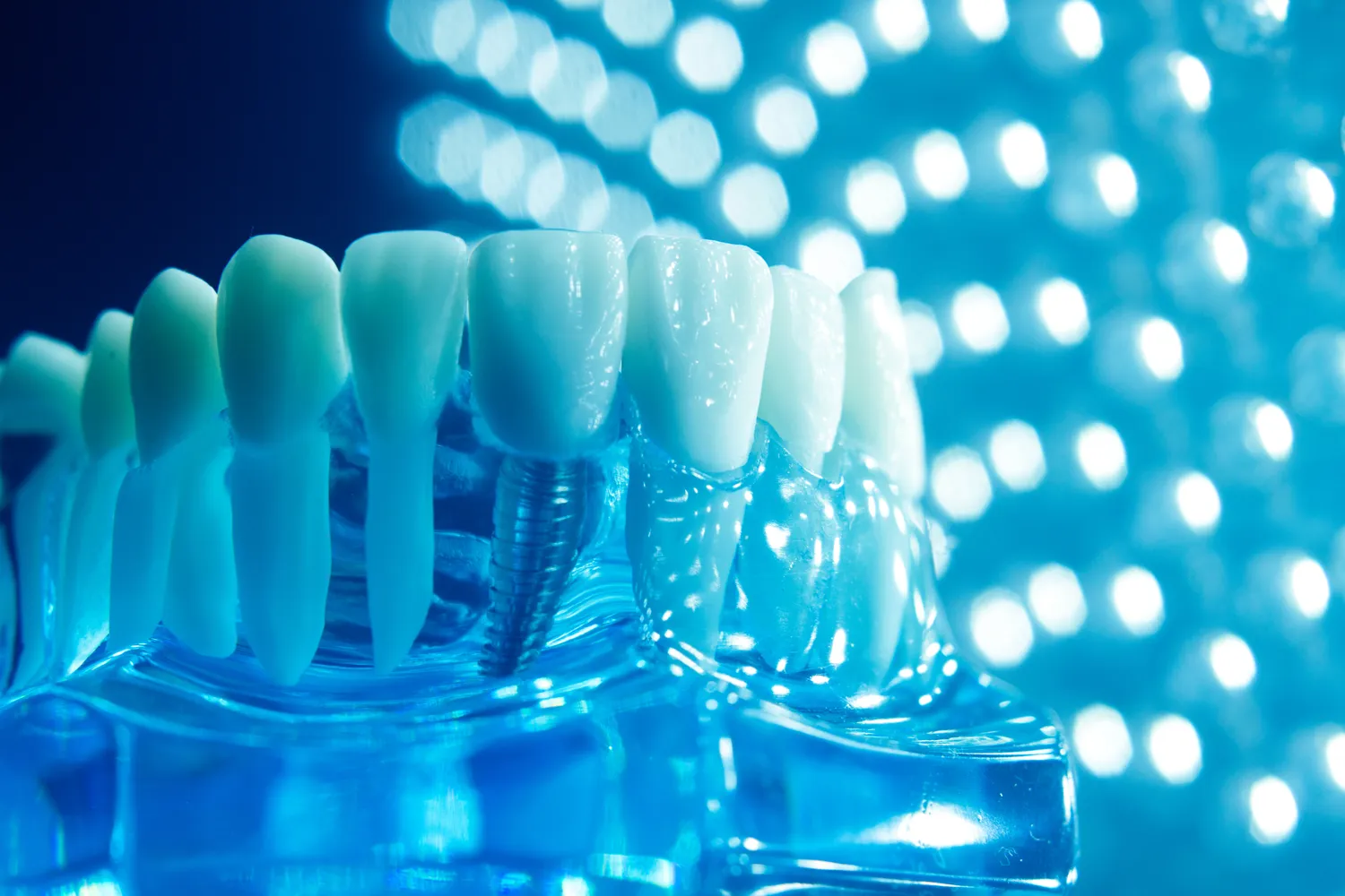 Najlepsza endodoncja Szczecin