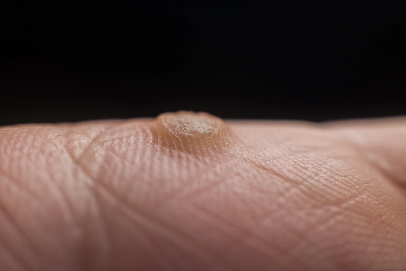 Dobry podolog a zdrowie i komfort stóp