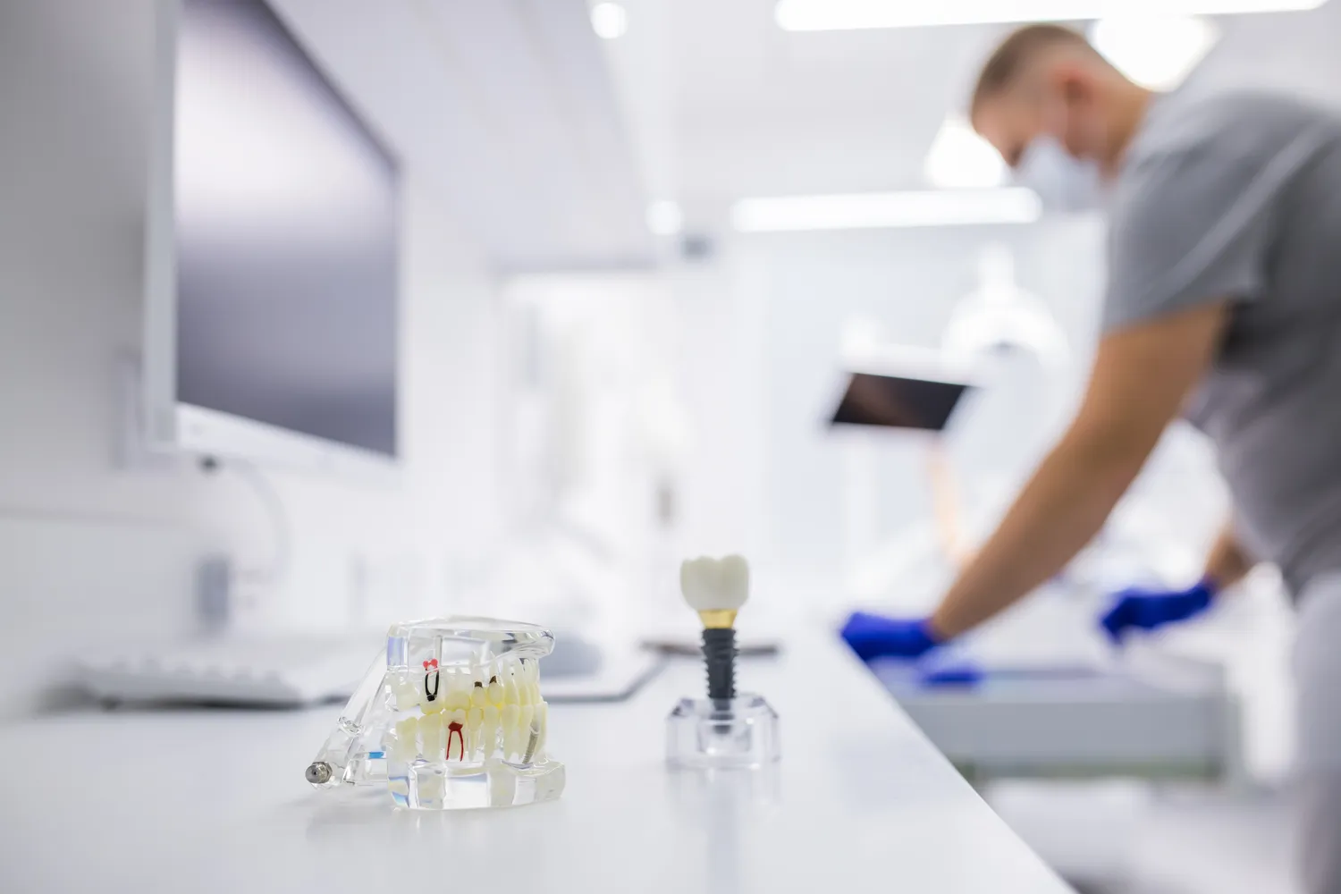 Ile trwa kanałowe leczenie?